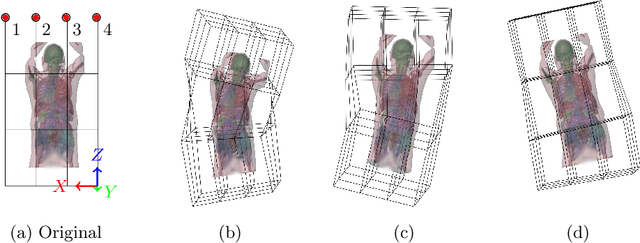 Figure 2 for LOOC: Localizing Organs using Occupancy Networks and Body Surface Depth Images