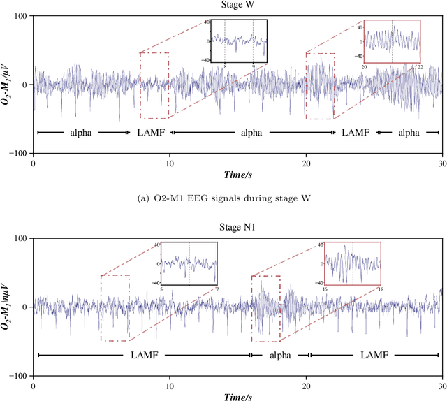 Figure 1 for An Interpretable and Efficient Sleep Staging Algorithm: DetectsleepNet