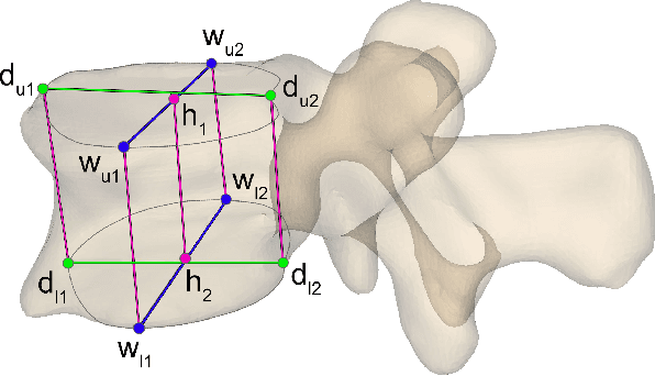 Figure 1 for 3D Vertebrae Measurements: Assessing Vertebral Dimensions in Human Spine Mesh Models Using Local Anatomical Vertebral Axes