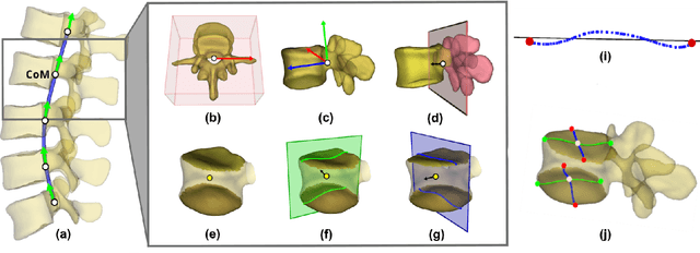 Figure 3 for 3D Vertebrae Measurements: Assessing Vertebral Dimensions in Human Spine Mesh Models Using Local Anatomical Vertebral Axes