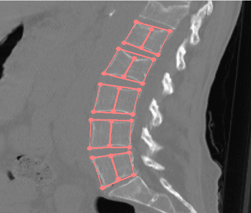 Figure 4 for 3D Vertebrae Measurements: Assessing Vertebral Dimensions in Human Spine Mesh Models Using Local Anatomical Vertebral Axes