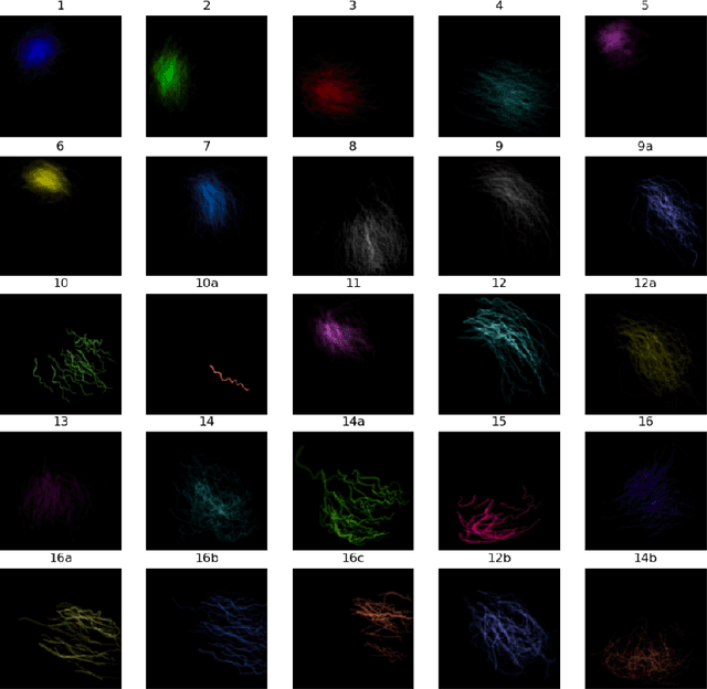 Figure 3 for Multivessel Coronary Artery Segmentation and Stenosis Localisation using Ensemble Learning