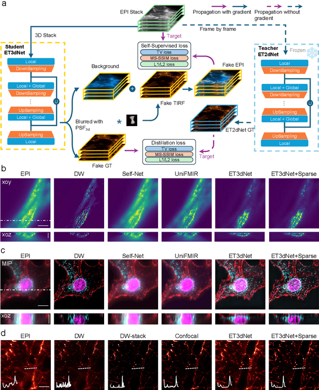 Figure 3 for Deep learning EPI-TIRF cross-modality enables background subtraction and axial super-resolution for widefield fluorescence microscopy