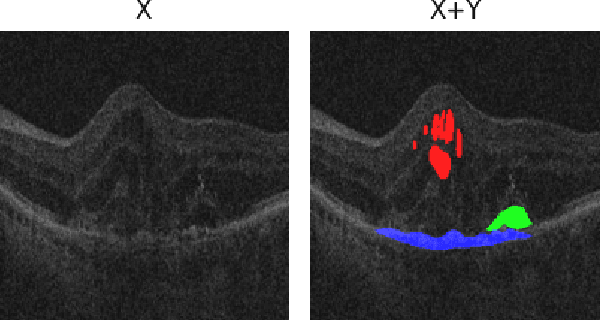 Figure 4 for Domain Generalization by Learning from Privileged Medical Imaging Information