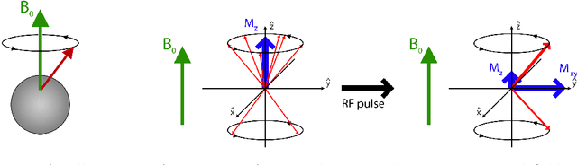 Figure 4 for Learning to sample in Cartesian MRI