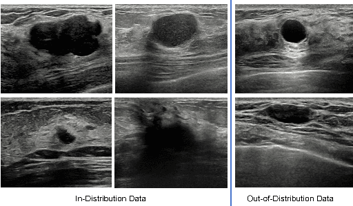 Figure 1 for TriAug: Out-of-Distribution Detection for Imbalanced Breast Lesion in Ultrasound