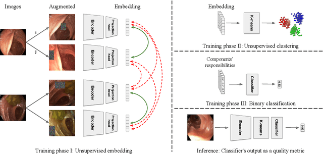 Figure 1 for Semi-supervised Quality Evaluation of Colonoscopy Procedures