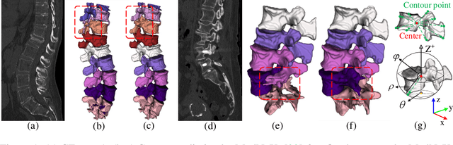 Figure 1 for SLoRD: Structural Low-Rank Descriptors for Shape Consistency in Vertebrae Segmentation