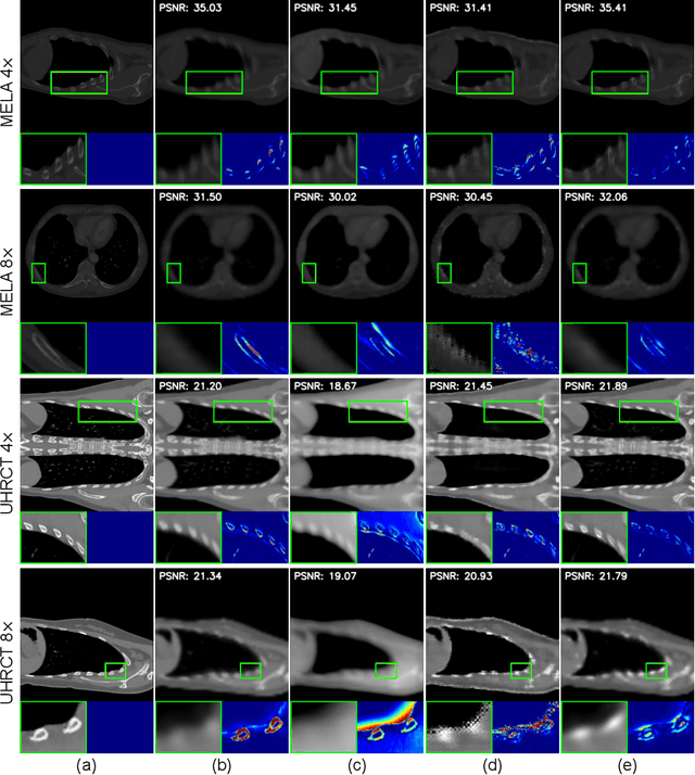 Figure 3 for Zero-shot Volumetric CT Super-Resolution using 3D Gaussian Splatting with Upsampled 2D X-ray Projection Priors
