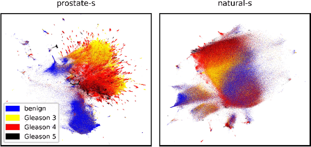 Figure 4 for HistoEncoder: a digital pathology foundation model for prostate cancer