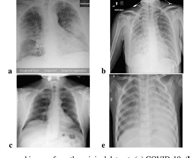 Figure 2 for Additional Look into GAN-based Augmentation for Deep Learning COVID-19 Image Classification