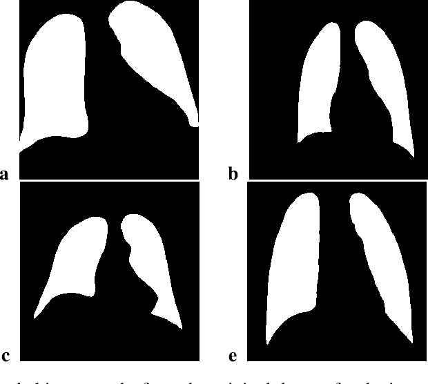 Figure 4 for Additional Look into GAN-based Augmentation for Deep Learning COVID-19 Image Classification