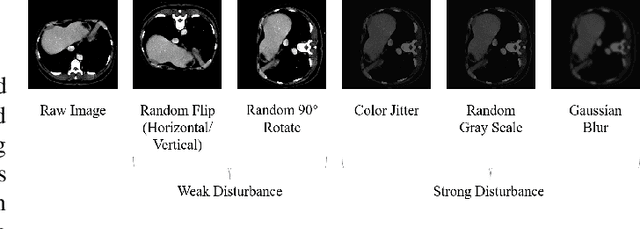 Figure 2 for UniMOS: A Universal Framework For Multi-Organ Segmentation Over Label-Constrained Datasets