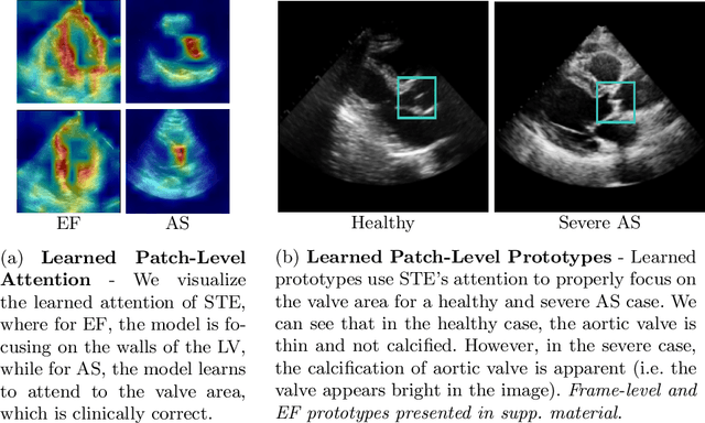 Figure 4 for GEMTrans: A General, Echocardiography-based, Multi-Level Transformer Framework for Cardiovascular Diagnosis