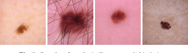 Figure 3 for Synthetic Generation of Dermatoscopic Images with GAN and Closed-Form Factorization