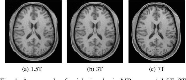 Figure 1 for Distillation-Driven Diffusion Model for Multi-Scale MRI Super-Resolution: Make 1.5T MRI Great Again