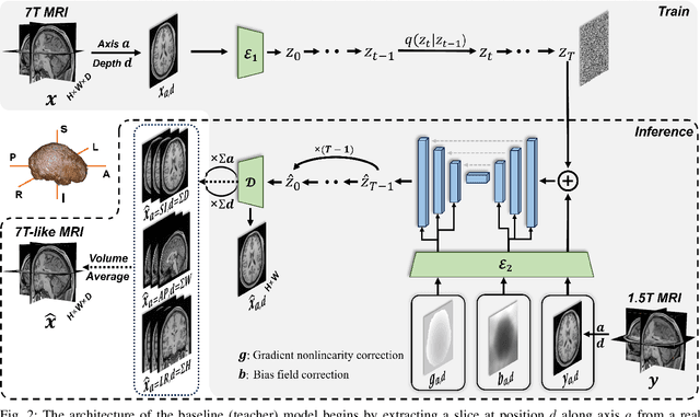 Figure 2 for Distillation-Driven Diffusion Model for Multi-Scale MRI Super-Resolution: Make 1.5T MRI Great Again