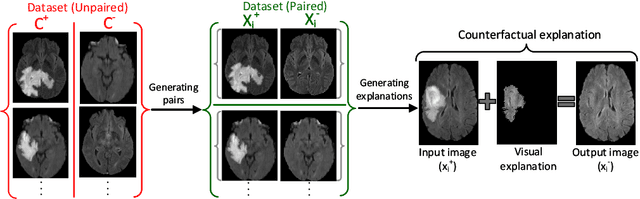 Figure 3 for Counterfactual Explanation and Instance-Generation using Cycle-Consistent Generative Adversarial Networks