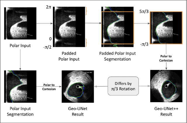 Figure 4 for Geo-UNet: A Geometrically Constrained Neural Framework for Clinical-Grade Lumen Segmentation in Intravascular Ultrasound