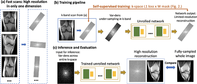 Figure 1 for K-band: Self-supervised MRI Reconstruction via Stochastic Gradient Descent over K-space Subsets