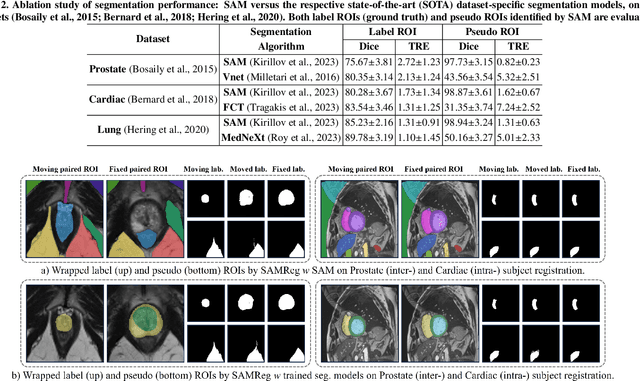 Figure 4 for SAMReg: SAM-enabled Image Registration with ROI-based Correspondence