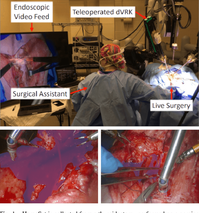 Figure 1 for HemoSet: The First Blood Segmentation Dataset for Automation of Hemostasis Management