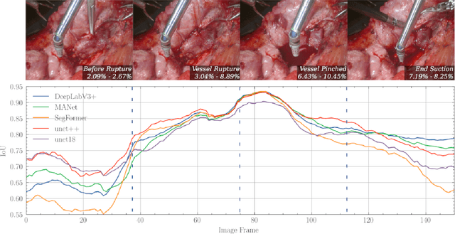 Figure 4 for HemoSet: The First Blood Segmentation Dataset for Automation of Hemostasis Management