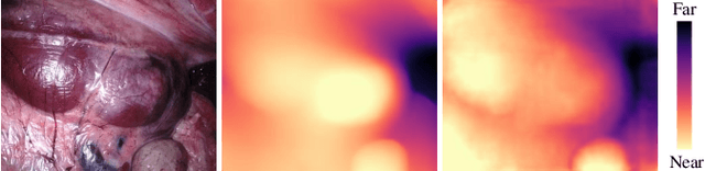 Figure 1 for Advancing Depth Anything Model for Unsupervised Monocular Depth Estimation in Endoscopy