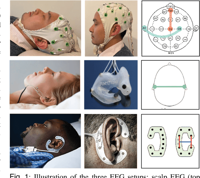 Figure 1 for L-SeqSleepNet: Whole-cycle Long Sequence Modelling for Automatic Sleep Staging