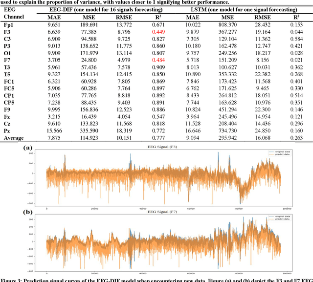 Figure 4 for EEG-DIF: Early Warning of Epileptic Seizures through Generative Diffusion Model-based Multi-channel EEG Signals Forecasting