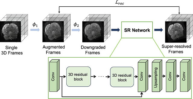 Figure 1 for Resolution- and Stimulus-agnostic Super-Resolution of Ultra-High-Field Functional MRI: Application to Visual Studies