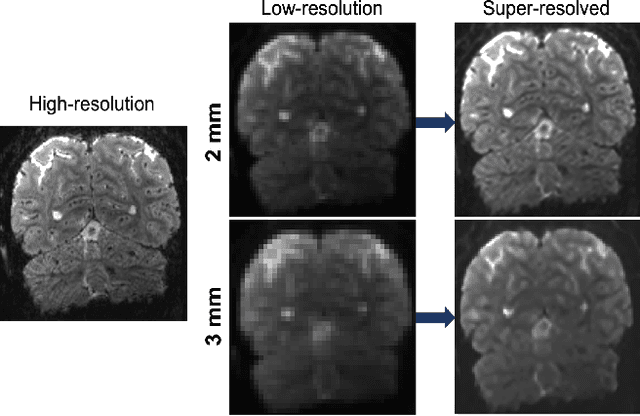 Figure 2 for Resolution- and Stimulus-agnostic Super-Resolution of Ultra-High-Field Functional MRI: Application to Visual Studies