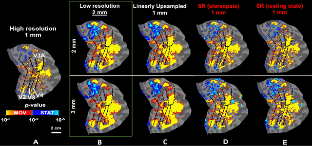 Figure 3 for Resolution- and Stimulus-agnostic Super-Resolution of Ultra-High-Field Functional MRI: Application to Visual Studies