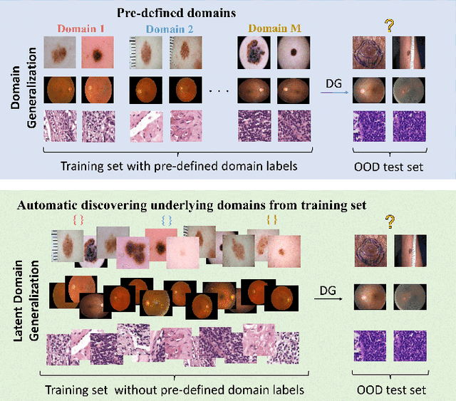 Figure 1 for Prompt-driven Latent Domain Generalization for Medical Image Classification