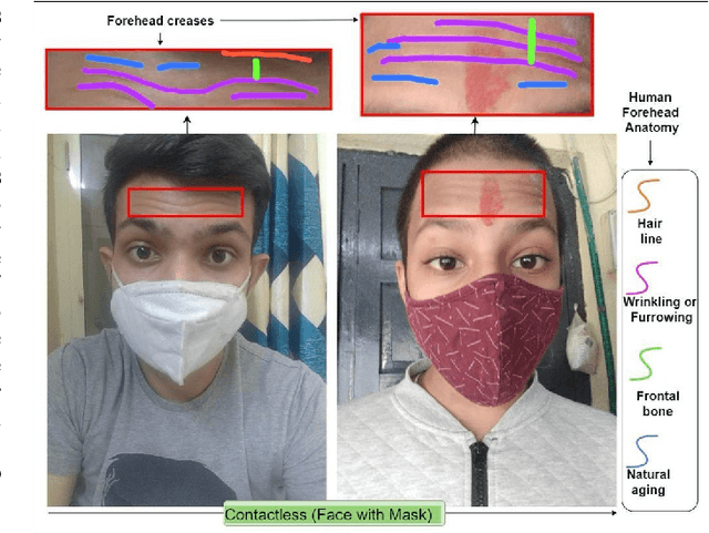 Figure 1 for FH-SSTNet: Forehead Creases based User Verification using Spatio-Spatial Temporal Network