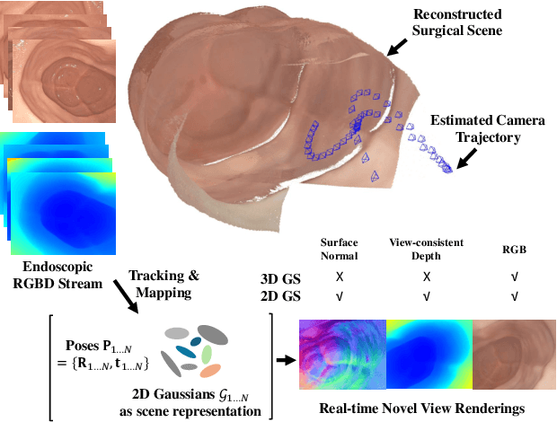 Figure 1 for Advancing Dense Endoscopic Reconstruction with Gaussian Splatting-driven Surface Normal-aware Tracking and Mapping