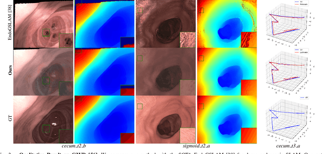 Figure 3 for Advancing Dense Endoscopic Reconstruction with Gaussian Splatting-driven Surface Normal-aware Tracking and Mapping