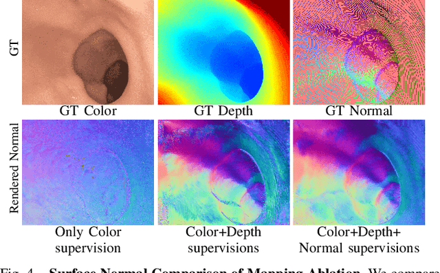 Figure 4 for Advancing Dense Endoscopic Reconstruction with Gaussian Splatting-driven Surface Normal-aware Tracking and Mapping