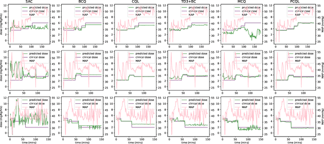 Figure 3 for Towards Safe Propofol Dosing during General Anesthesia Using Deep Offline Reinforcement Learning