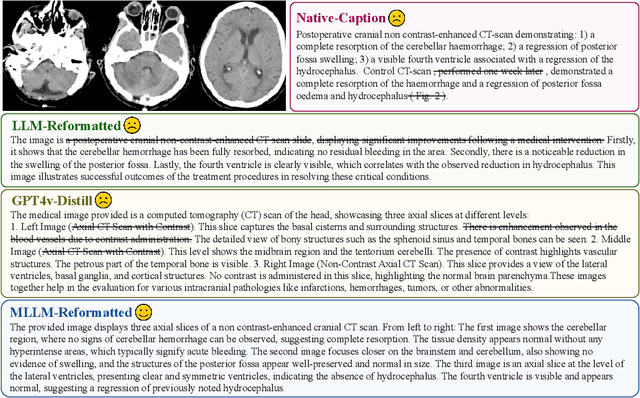 Figure 2 for HuatuoGPT-Vision, Towards Injecting Medical Visual Knowledge into Multimodal LLMs at Scale