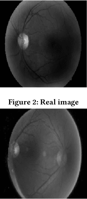Figure 3 for Diabetic Retinopathy Detection Using CNN with Residual Block with DCGAN