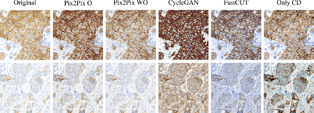 Figure 4 for Color Deconvolution applied to Domain Adaptation in HER2 histopathological images