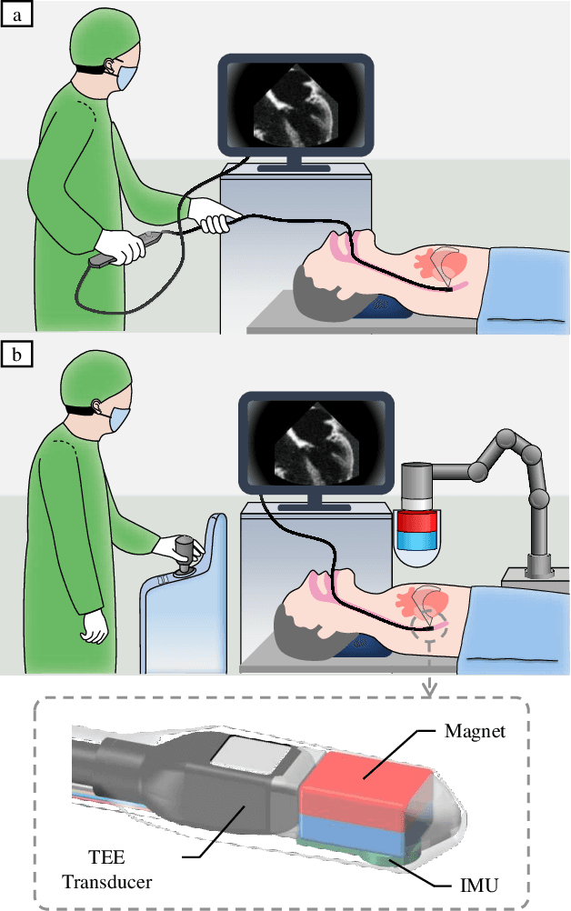 Figure 1 for Closed-Loop Magnetic Manipulation for Robotic Transesophageal Echocardiography