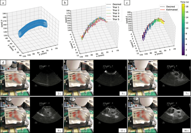 Figure 2 for Closed-Loop Magnetic Manipulation for Robotic Transesophageal Echocardiography
