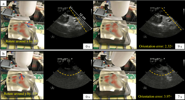 Figure 3 for Closed-Loop Magnetic Manipulation for Robotic Transesophageal Echocardiography