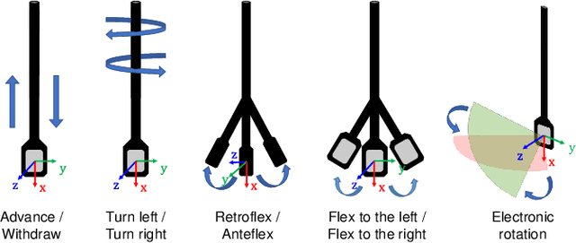 Figure 4 for Closed-Loop Magnetic Manipulation for Robotic Transesophageal Echocardiography