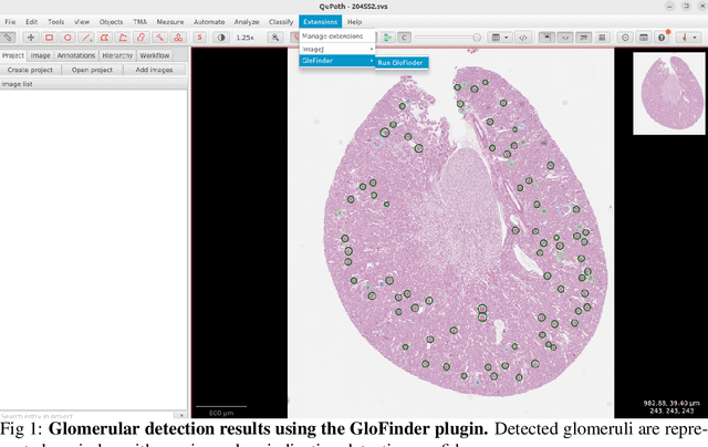 Figure 1 for GloFinder: AI-empowered QuPath Plugin for WSI-level Glomerular Detection, Visualization, and Curation