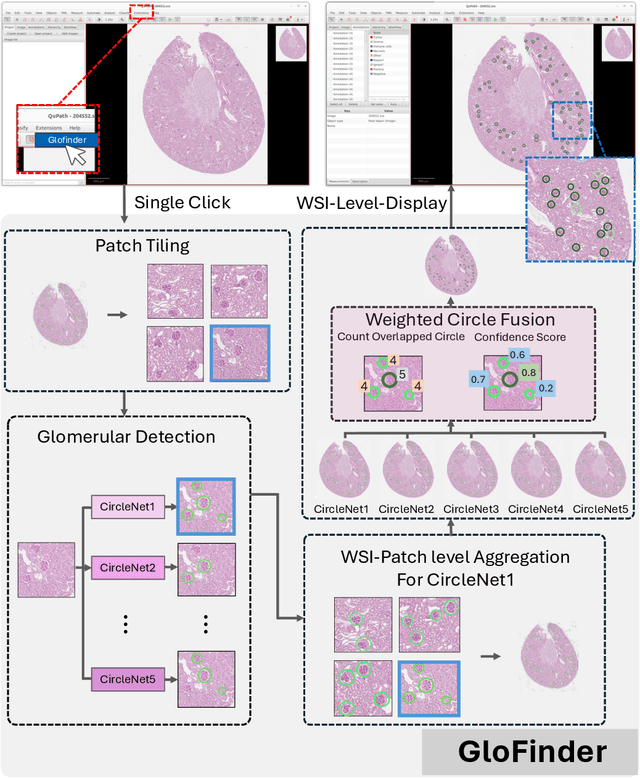 Figure 3 for GloFinder: AI-empowered QuPath Plugin for WSI-level Glomerular Detection, Visualization, and Curation