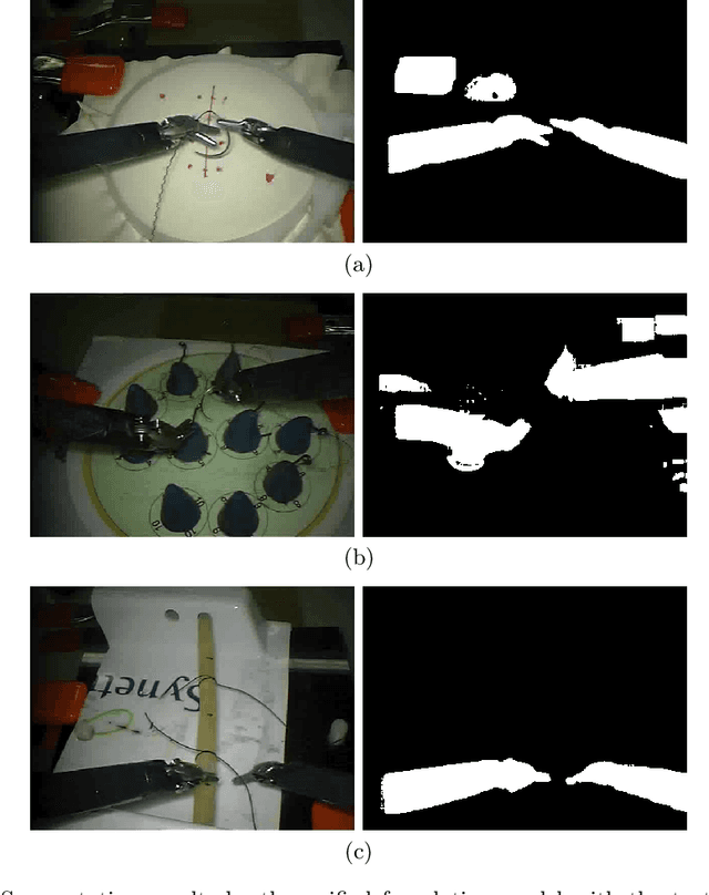 Figure 3 for ZEAL: Surgical Skill Assessment with Zero-shot Tool Inference Using Unified Foundation Model