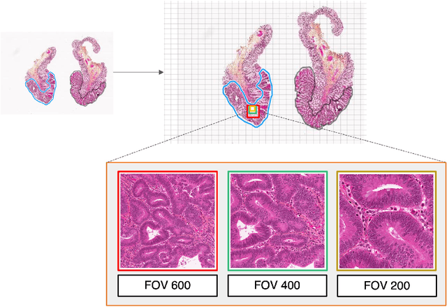 Figure 1 for Comparative Analysis of Diffusion Generative Models in Computational Pathology